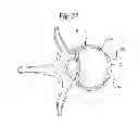 Fig. 11 - ANNULUS-REINFORCING BAND