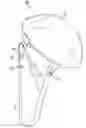 Fig. 01 - Fenestrated humeral prosthesis and methods of shoulder arthroplasty
