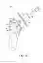 Fig. 03 - Fenestrated humeral prosthesis and methods of shoulder arthroplasty