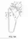 Fig. 12 - Fenestrated humeral prosthesis and methods of shoulder arthroplasty