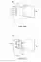 Fig. 13 - Fenestrated humeral prosthesis and methods of shoulder arthroplasty