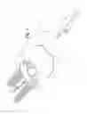 Fig. 04 - Prosthetic wrist implant