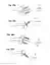 Fig. 12 - Prosthetic wrist implant