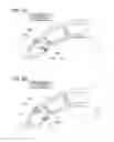 Fig. 07 - Finger assist device