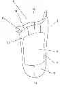 Fig. 01 - Prosthesis socket