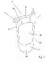 Fig. 02 - Prosthesis socket