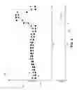 Fig. 04 - Rain onset detection glazing auto-close