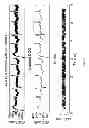 Fig. 04 - Technique for real-time removal of power line interference in ECG