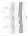 Fig. 02 - Zonal allocation for multilayered subterranean reservoirs