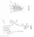 Fig. 03 - Protective glove