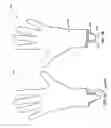 Fig. 04 - Protective glove