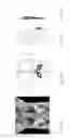 Fig. 22 - Supporting and protecting article for the human torso