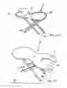 Fig. 02 - Treatment device
