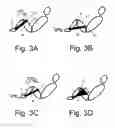 Fig. 03 - Stabilizing apparatus for inclined legs