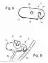 Fig. 05 - Stabilizing apparatus for inclined legs