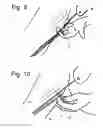 Fig. 07 - Stabilizing apparatus for inclined legs