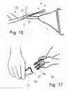 Fig. 10 - Stabilizing apparatus for inclined legs