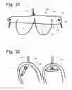 Fig. 19 - Stabilizing apparatus for inclined legs