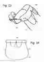 Fig. 20 - Stabilizing apparatus for inclined legs