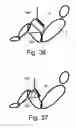Fig. 22 - Stabilizing apparatus for inclined legs