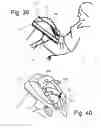 Fig. 24 - Stabilizing apparatus for inclined legs