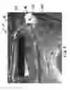 Fig. 04 - Plumbing fixture cleaning device