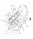 Fig. 02 - Methods and devices for retrofitting footwear to include a reel based closure system