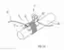 Fig. 06 - ATTACHMENT DEVICE FOR ATTACHING A RIGID BODY TO AN ARBITRARY MEDICAL INSTRUMENT