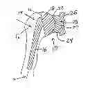 Fig. 01 - Method for optimization of joint arthroplasty component design