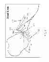 Fig. 07 - Method for optimization of joint arthroplasty component design