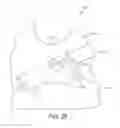 Fig. 22 - Method of bonding PEBA plastic composition