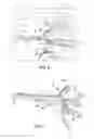 Fig. 06 - Integrated bipod tension stabilization rifle sling