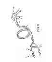 Fig. 05 - Fish netting tool