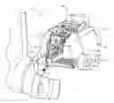 Fig. 01 - Agricultural baler needle stabilizer