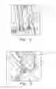 Fig. 03 - Agricultural baler needle stabilizer