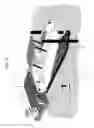 Fig. 05 - KEEL CASE