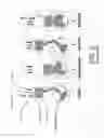 Fig. 03 - One-stroke internal combustion engine