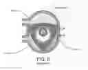 Fig. 07 - One-stroke internal combustion engine