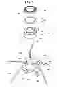 Fig. 03 - Hose burner
