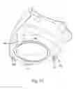 Fig. 12 - Tub for humidifier