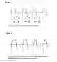 Fig. 02 - Method and device for carrying out a signal-processing viewing of a measurement signal that is correlated to the respiratory activity of an individual