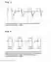 Fig. 03 - Method and device for carrying out a signal-processing viewing of a measurement signal that is correlated to the respiratory activity of an individual