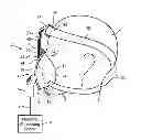 Fig. 01 - Patient interface device with nose bridge adjustment