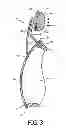 Fig. 04 - Patient interface device with nose bridge adjustment