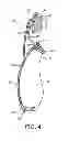 Fig. 05 - Patient interface device with nose bridge adjustment