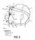 Fig. 06 - Patient interface device with nose bridge adjustment