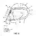 Fig. 07 - Patient interface device with nose bridge adjustment