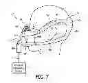 Fig. 08 - Patient interface device with nose bridge adjustment
