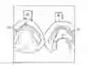 Fig. 01 - Custom Mouthguard