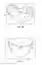 Fig. 04 - Custom Mouthguard